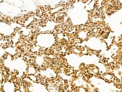Invitrogen TUT1 Polyclonal Antibody 100 &mu;L; Unconjugated:Antibodies,