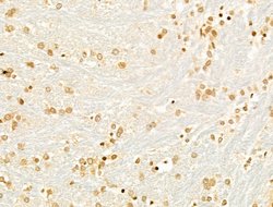 Invitrogen TUT1 Polyclonal Antibody 100 &mu;L; Unconjugated:Antibodies,