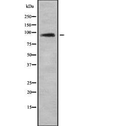 Invitrogen TUT1 Polyclonal Antibody 100 &mu;L; Unconjugated:Antibodies,