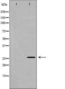 Invitrogen Ubiquitin Polyclonal Antibody 100 &mu;L; Unconjugated:Antibodies,