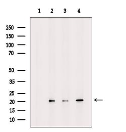 Invitrogen UBE2G1 Polyclonal Antibody 100 &mu;L; Unconjugated:Antibodies,