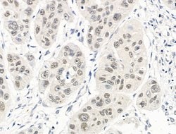 Invitrogen UBR4 Polyclonal Antibody 100 &mu;L; Unconjugated:Antibodies,