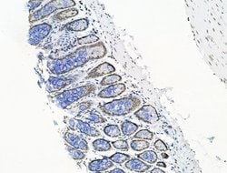 Invitrogen UBR4 Polyclonal Antibody 100 &mu;L; Unconjugated:Antibodies,