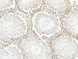 Invitrogen UBR4 Polyclonal Antibody 100 &mu;L; Unconjugated:Antibodies,