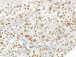 Invitrogen UBR4 Polyclonal Antibody 100 &mu;L; Unconjugated:Antibodies,