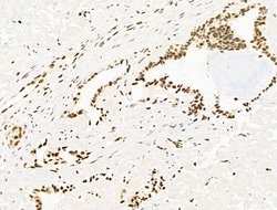 Invitrogen UBR4 Polyclonal Antibody 100 &mu;L; Unconjugated:Antibodies,