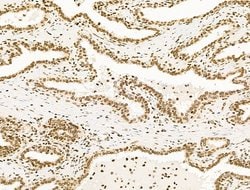Invitrogen UBR4 Polyclonal Antibody 100 &mu;L; Unconjugated:Antibodies,