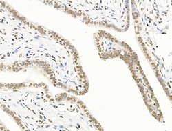 Invitrogen UBR4 Polyclonal Antibody 100 &mu;L; Unconjugated:Antibodies,