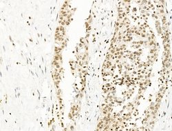 Invitrogen UBR4 Polyclonal Antibody 100 &mu;L; Unconjugated:Antibodies,
