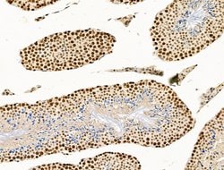 Invitrogen UBR4 Polyclonal Antibody 100 &mu;L; Unconjugated:Antibodies,