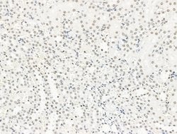 Invitrogen UBR4 Polyclonal Antibody 100 &mu;L; Unconjugated:Antibodies,