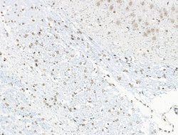 Invitrogen UBR4 Polyclonal Antibody 100 &mu;L; Unconjugated:Antibodies,