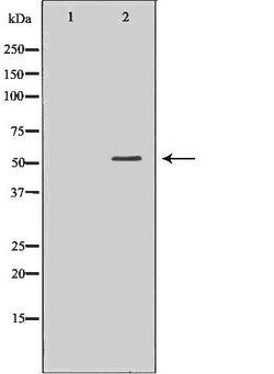 Invitrogen UGDH Polyclonal Antibody 100 &mu;L; Unconjugated:Antibodies,