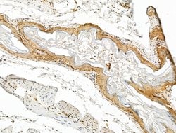 UGT1A6 Polyclonal Antibody:Antibodies, Polyclonal