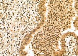 Invitrogen UHRF1 Polyclonal Antibody 100 μL; Unconjugated:Antibodies,