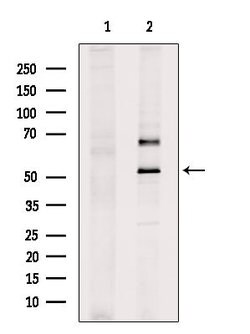 Invitrogen UMPS Polyclonal Antibody 100 &mu;L; Unconjugated:Antibodies,