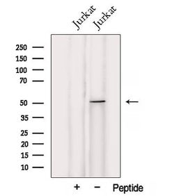 Invitrogen UMPS Polyclonal Antibody 100 &mu;L; Unconjugated:Antibodies,