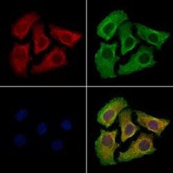 Invitrogen UNC5B Polyclonal Antibody 100 &mu;L; Unconjugated:Antibodies,