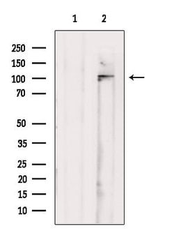 Invitrogen UNC5B Polyclonal Antibody 100 &mu;L; Unconjugated:Antibodies,