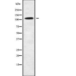 Invitrogen USP35 Polyclonal Antibody 100 &mu;L; Unconjugated:Antibodies,