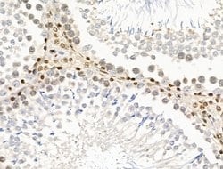 Invitrogen UXT Polyclonal Antibody 100 &mu;L; Unconjugated:Antibodies,