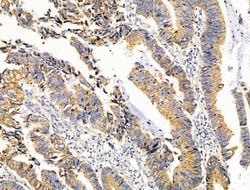 Invitrogen VDAC2 Polyclonal Antibody 100 &mu;L; Unconjugated:Antibodies,