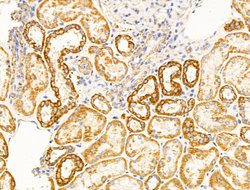 Invitrogen VDAC2 Polyclonal Antibody 100 &mu;L; Unconjugated:Antibodies,