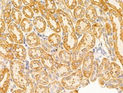 Invitrogen VDAC2 Polyclonal Antibody 100 &mu;L; Unconjugated:Antibodies,