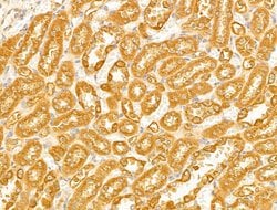 Invitrogen VDAC2 Polyclonal Antibody 100 &mu;L; Unconjugated:Antibodies,
