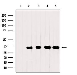 Invitrogen VDAC2 Polyclonal Antibody 100 &mu;L; Unconjugated:Antibodies,