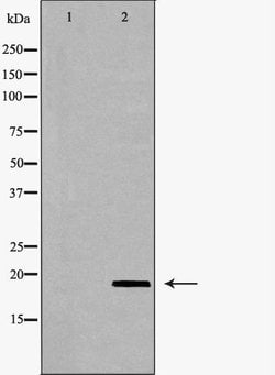 Invitrogen VEGFB Polyclonal Antibody 100 &mu;L; Unconjugated:Antibodies,
