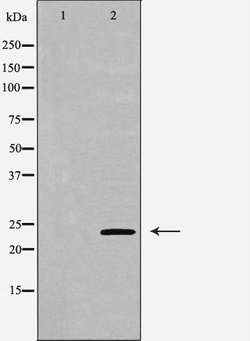 Invitrogen VHL Polyclonal Antibody 100 &mu;L; Unconjugated:Antibodies,