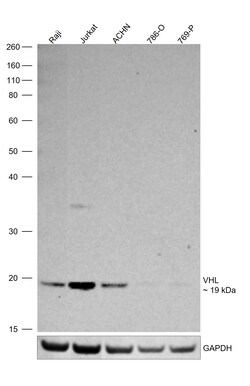 Invitrogen VHL Polyclonal Antibody 100 &mu;L; Unconjugated:Antibodies,