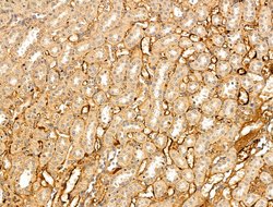 Invitrogen VLDLR Polyclonal Antibody 100 &mu;L; Unconjugated:Antibodies,