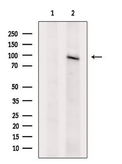 Invitrogen VLDLR Polyclonal Antibody 100 &mu;L; Unconjugated:Antibodies,