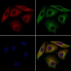 Invitrogen VPS29 Polyclonal Antibody 100 μL; Unconjugated:Antibodies,