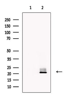 Invitrogen VPS29 Polyclonal Antibody 100 μL; Unconjugated:Antibodies,
