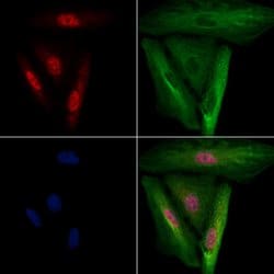 Invitrogen CHX10 Polyclonal Antibody 100 &mu;L | Buy Online | Invitrogen&trade; | Fisher Scientific