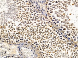 Invitrogen CHX10 Polyclonal Antibody 100 &mu;L | Buy Online | Invitrogen&trade; | Fisher Scientific