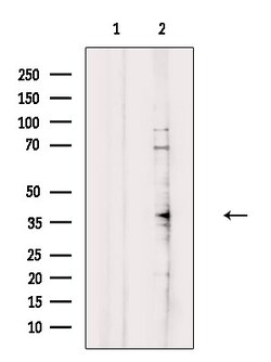 Invitrogen CHX10 Polyclonal Antibody 100 &mu;L | Buy Online | Invitrogen&trade; | Fisher Scientific