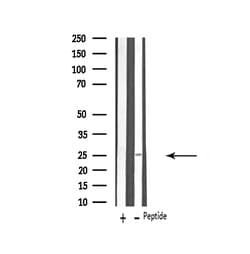 Invitrogen VTI1B Polyclonal Antibody 100 &mu;L; Unconjugated:Antibodies,