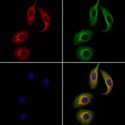 Invitrogen WNT3 Polyclonal Antibody 100 &mu;L; Unconjugated:Antibodies,