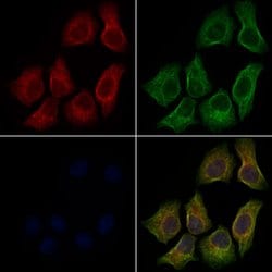 Invitrogen WNT9B Polyclonal Antibody 100 &mu;L; Unconjugated:Antibodies,