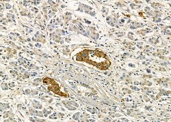 Invitrogen XCR1 Polyclonal Antibody 100 &mu;L; Unconjugated:Antibodies,