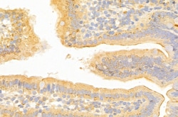 Invitrogen SLC7A11 Polyclonal Antibody 100 &mu;L | Buy Online | Invitrogen&trade; | Fisher Scientific