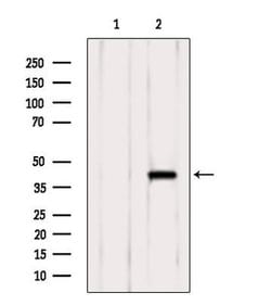 Invitrogen SLC7A11 Polyclonal Antibody 100 &mu;L | Buy Online | Invitrogen&trade; | Fisher Scientific