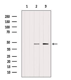 Invitrogen SLC7A11 Polyclonal Antibody 100 &mu;L | Buy Online | Invitrogen&trade; | Fisher Scientific