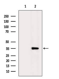 Invitrogen XRCC4 Polyclonal Antibody 100 &mu;L; Unconjugated:Antibodies,