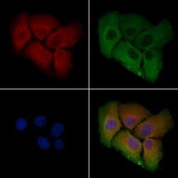 Invitrogen ZDHHC7 Polyclonal Antibody 100 &mu;L; Unconjugated:Antibodies,