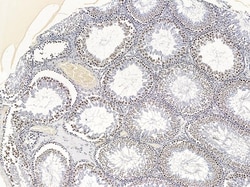 ZEB1 Polyclonal Antibody:Antibodies, Polyclonal